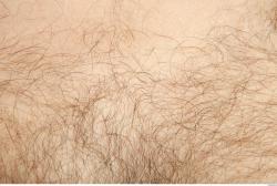 Photo Textures of Human Skin